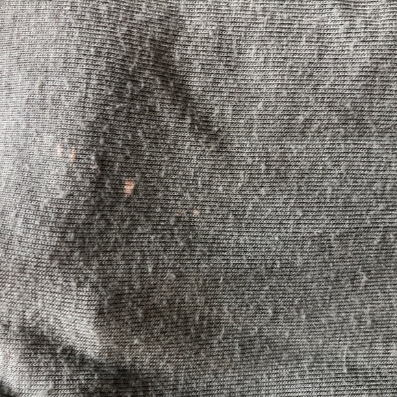 Abercrombie romper - Picture 4 of 4